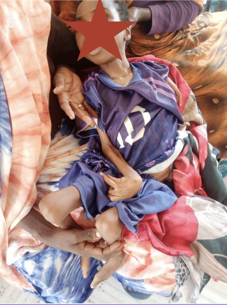 تضاعف عدد الأطفال المصابين بسوء التغذية الحاد في شمال دارفور