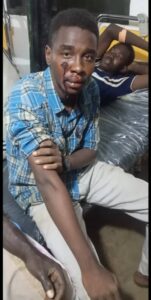 مصاب في بيالي