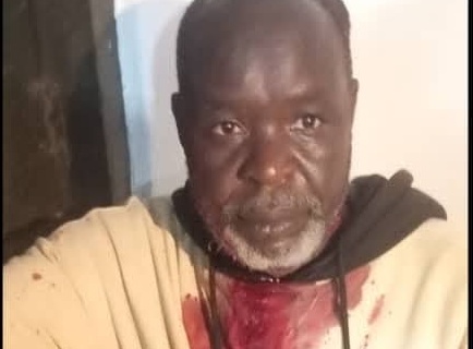 مصاب في أحداث بيالي